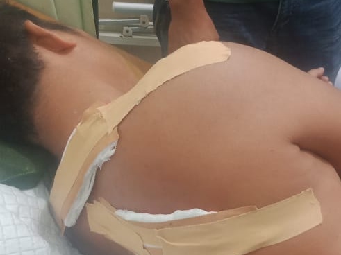 Interaksi Negatif Satwa, Warga Pelalawan Diserang Gajah Liar